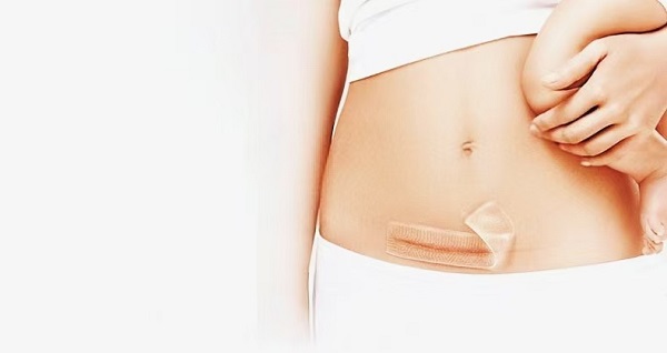 ทำไมแผ่นแผลเป็นเจลซิลิโคนหนาถึงได้รับความนิยม?