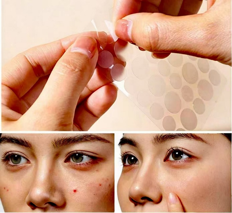วิธีใช้แผ่นแปะสิว CmallBio ข้ามคืนเพื่อผลลัพธ์สูงสุด？